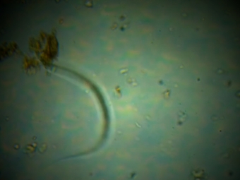 Nematoide - 16:9