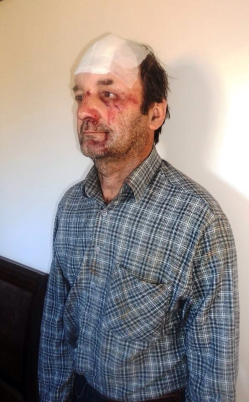 Produtor rural Ademar Benetti após ser agredido por indígenas
