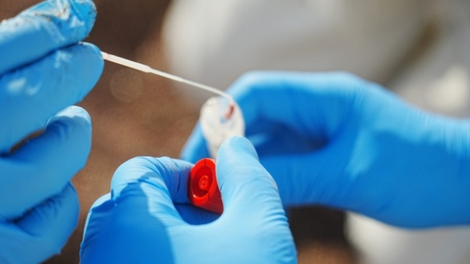 Embrapa: Influenza aviária acende alerta no Brasil